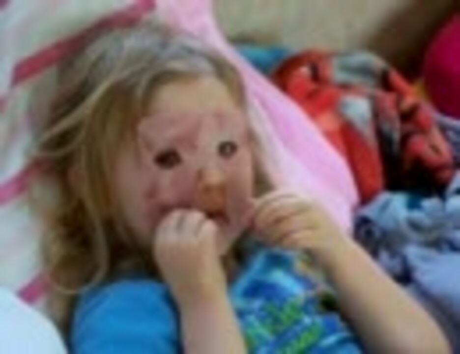 顔の皮膚がグロくなっている外国人の子供 幼女 ニコニコ動画