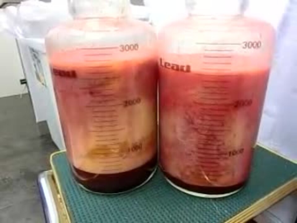 脂肪吸引 劇的ビフォーアフター 整形手術 名倉 ニコニコ動画