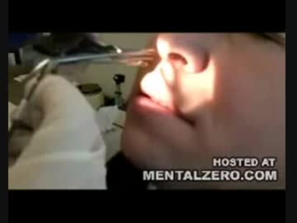 巨大な鼻くそを鼻の奥から引きずり出す グロ注意 ニコニコ動画