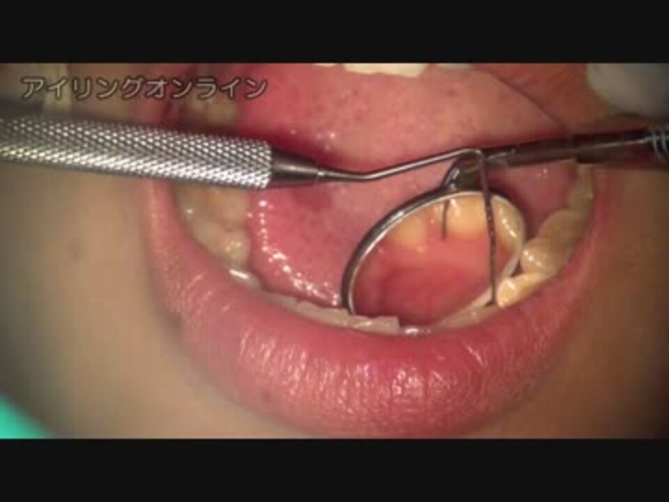 人気の 虫歯 動画 97本 2 ニコニコ動画