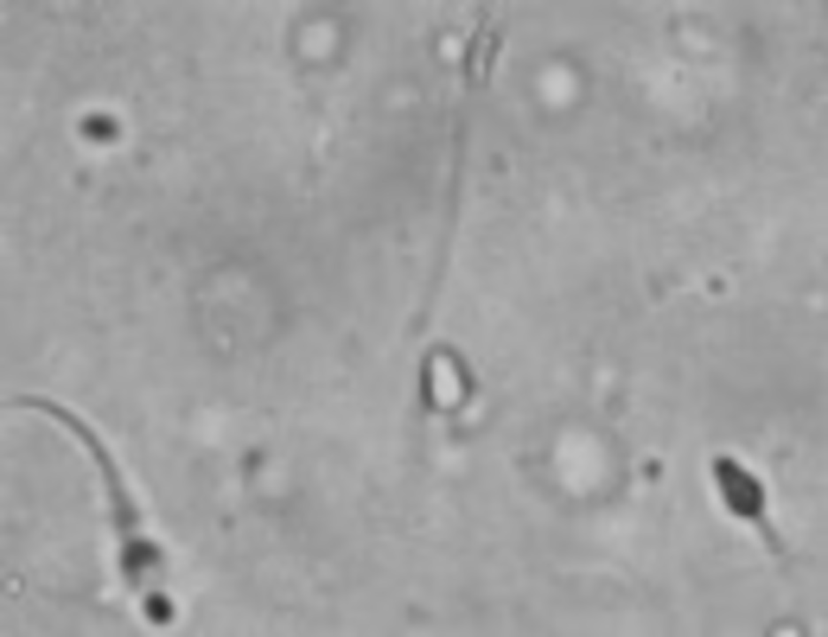 顕微鏡で 我が子の素 録画してみた ニコニコ動画