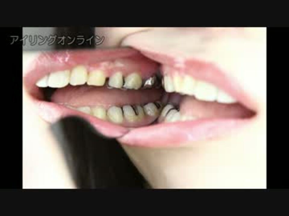 人気の 虫歯 動画 91本 2 ニコニコ動画