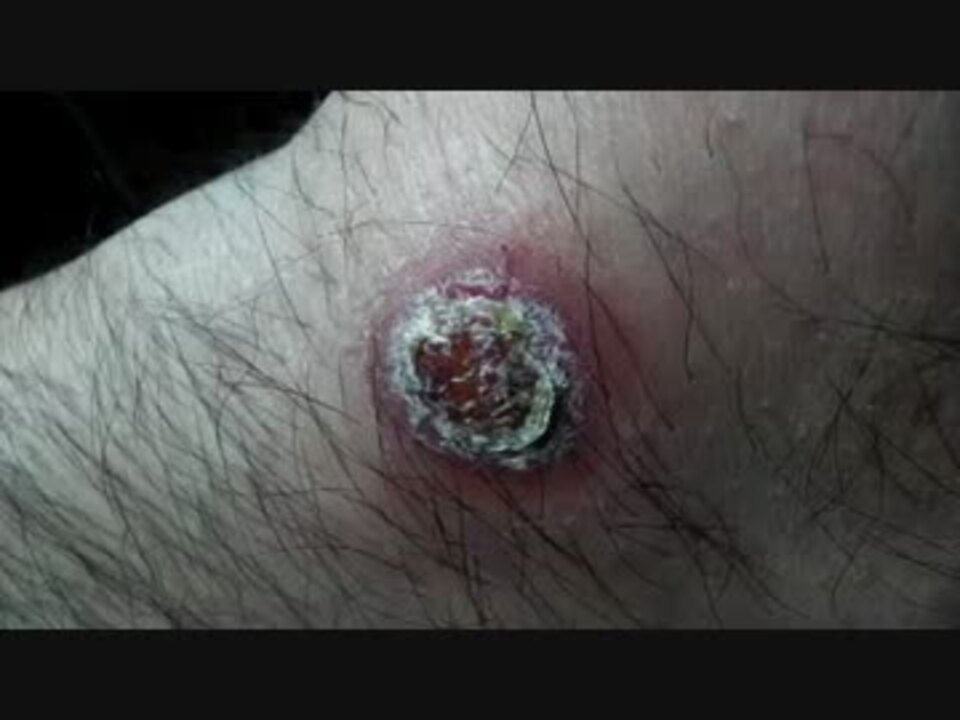 人気の 医療動画 動画 7本 ニコニコ動画