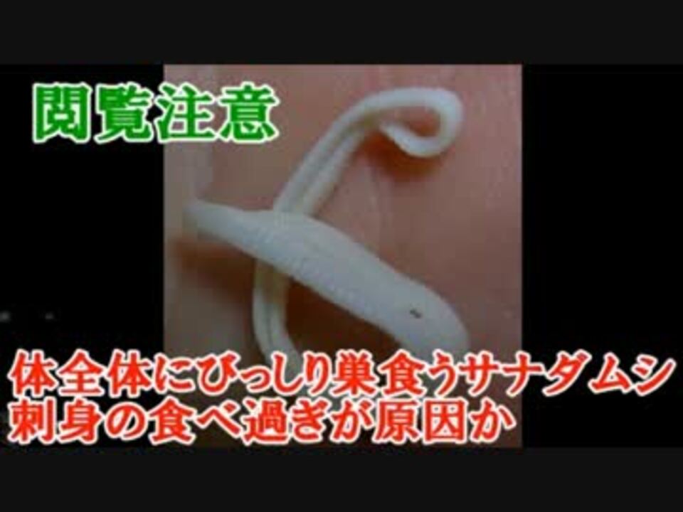 体全体にびっしり巣食うサナダムシ 刺身の食べ過ぎが原因か ニコニコ動画