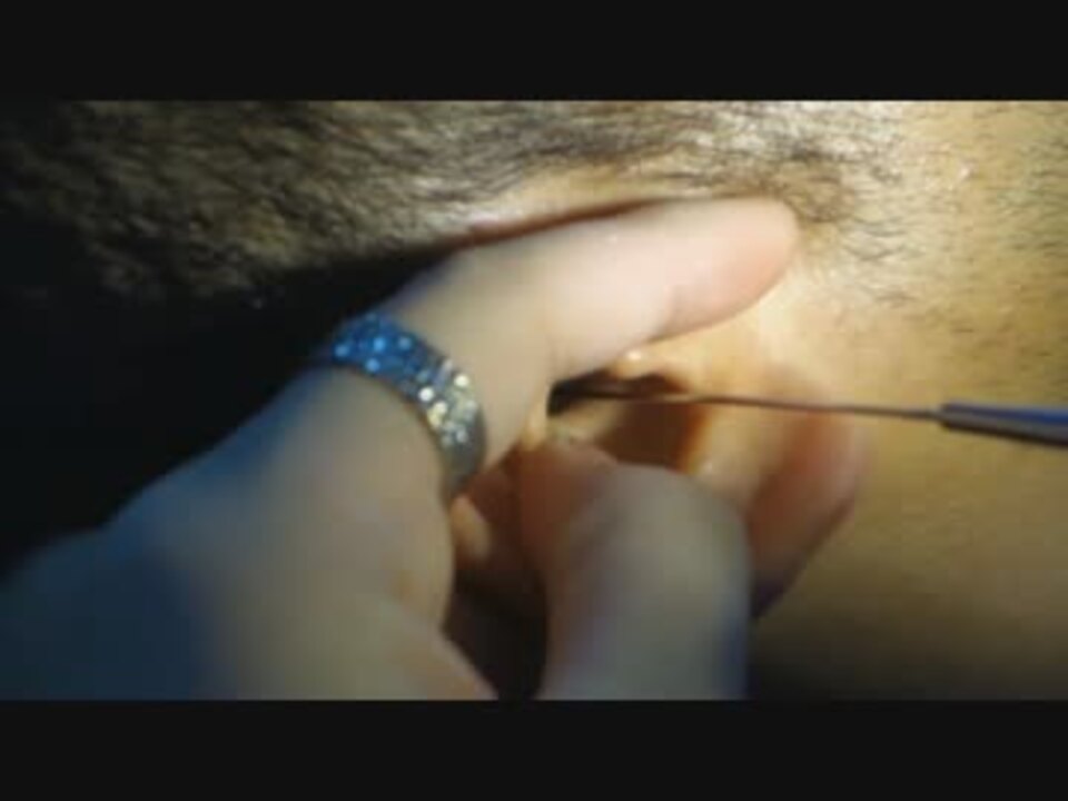 穴刀でショリショリ Ear Cleaning And Ear Wax Relaxation Complete Procedure 10 ニコニコ動画