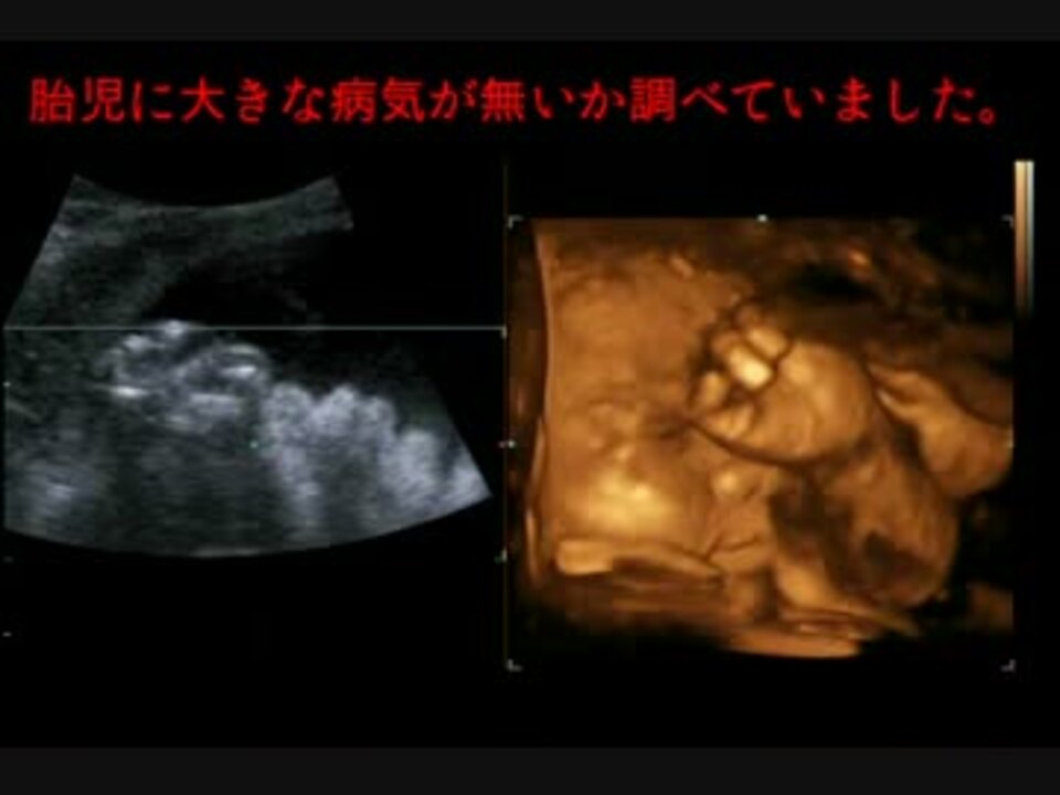 エコー 赤ちゃん 28週 ニコニコ動画