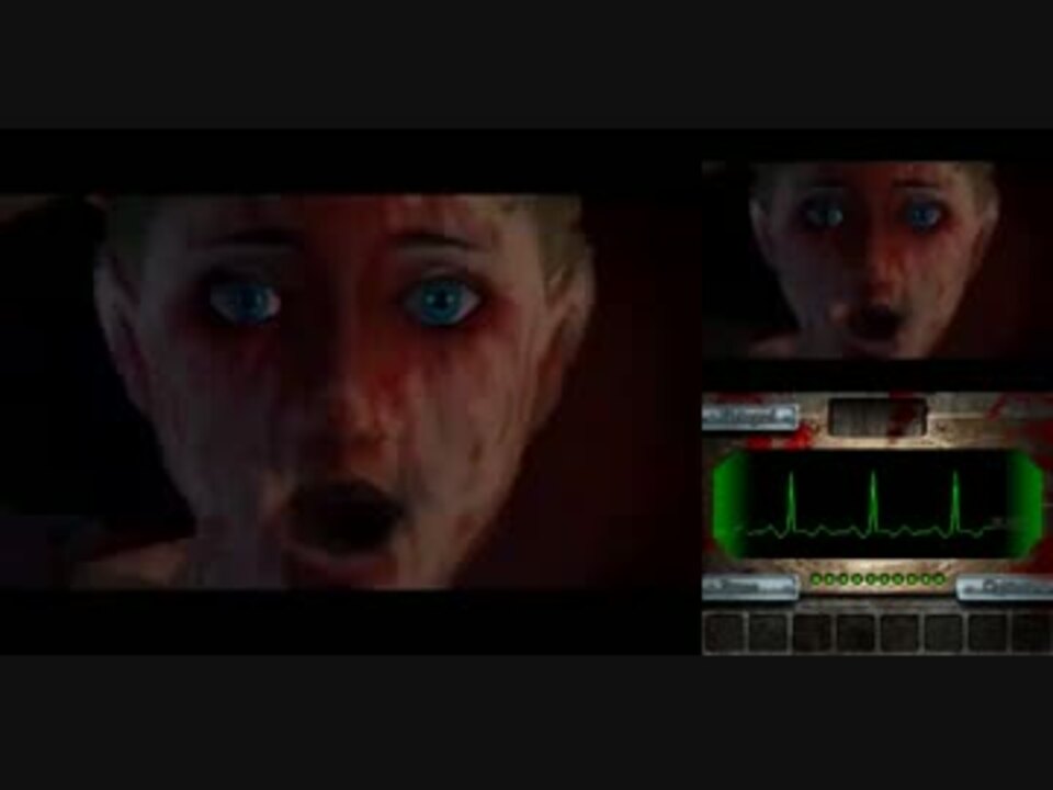 【TAS】DEMENTIUM:THE WARD（日本版：DEMENTIUM 閉鎖病棟）36:56