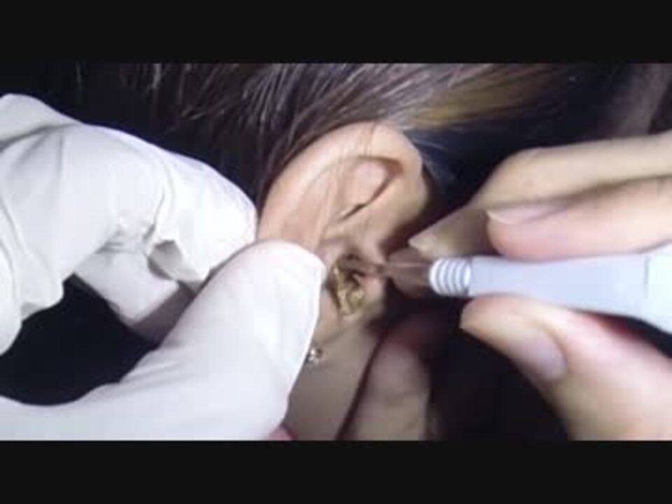 16年に耳垢が最も多かった女性 ニコニコ動画