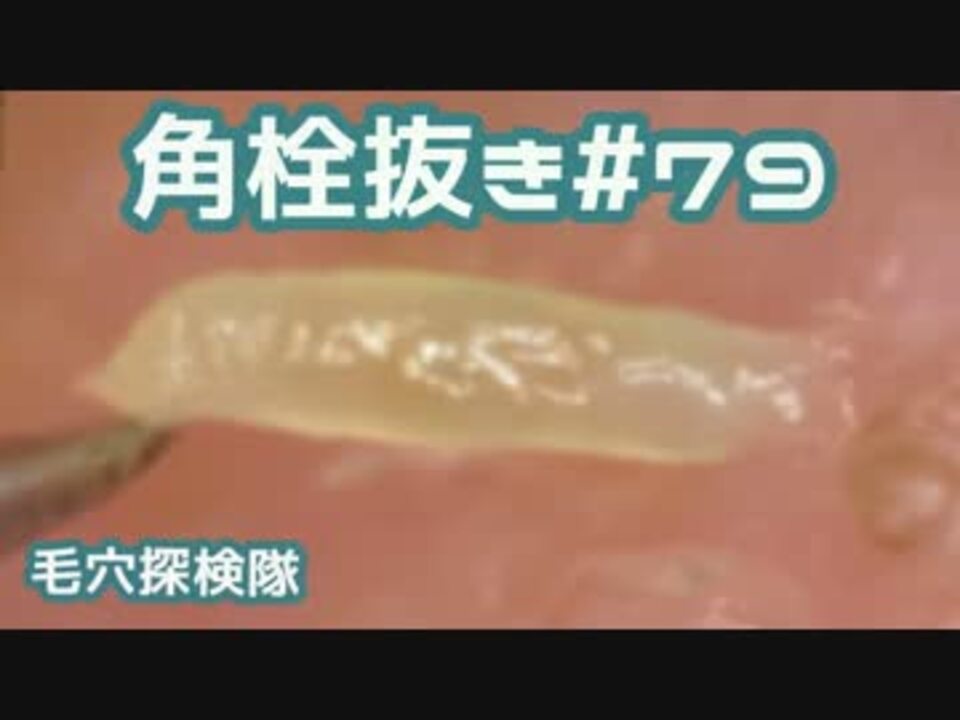 人気の 角栓 動画 178本 2 ニコニコ動画