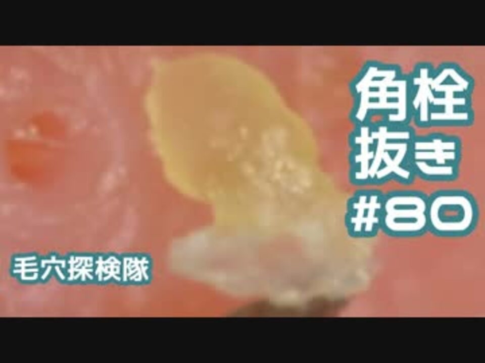 人気の 毛穴探検隊 動画 46本 ニコニコ動画