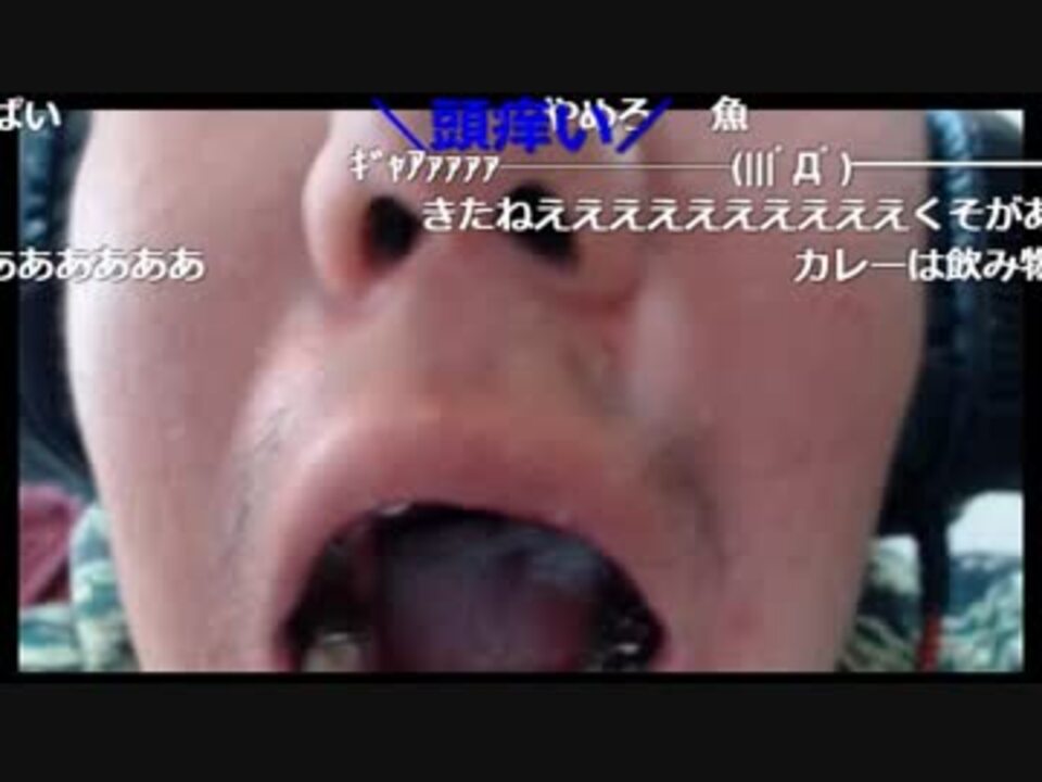 ジンギスカン ２４歳の妖怪 無事に歯の手術が終わりました 17 10 19 ニコニコ動画