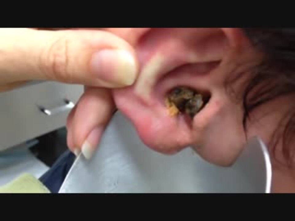 ホモと学ぶ耳洗浄 Mimikuso ニコニコ動画