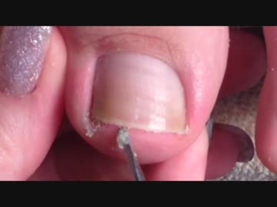 足の爪の汚れをほじってお掃除 ンギモチ ィイイ ニコニコ動画