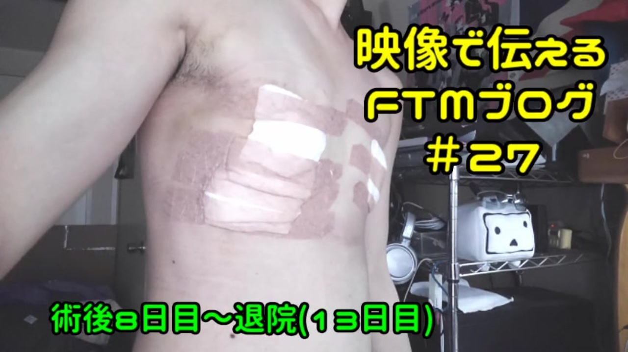 性同一性障害ftmブログ 27 性別適合手術その4 ニコニコ動画