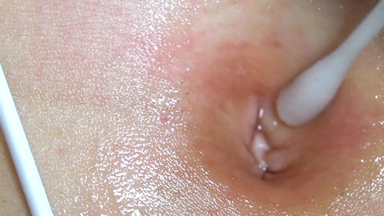 へそのごま 巨大 動画