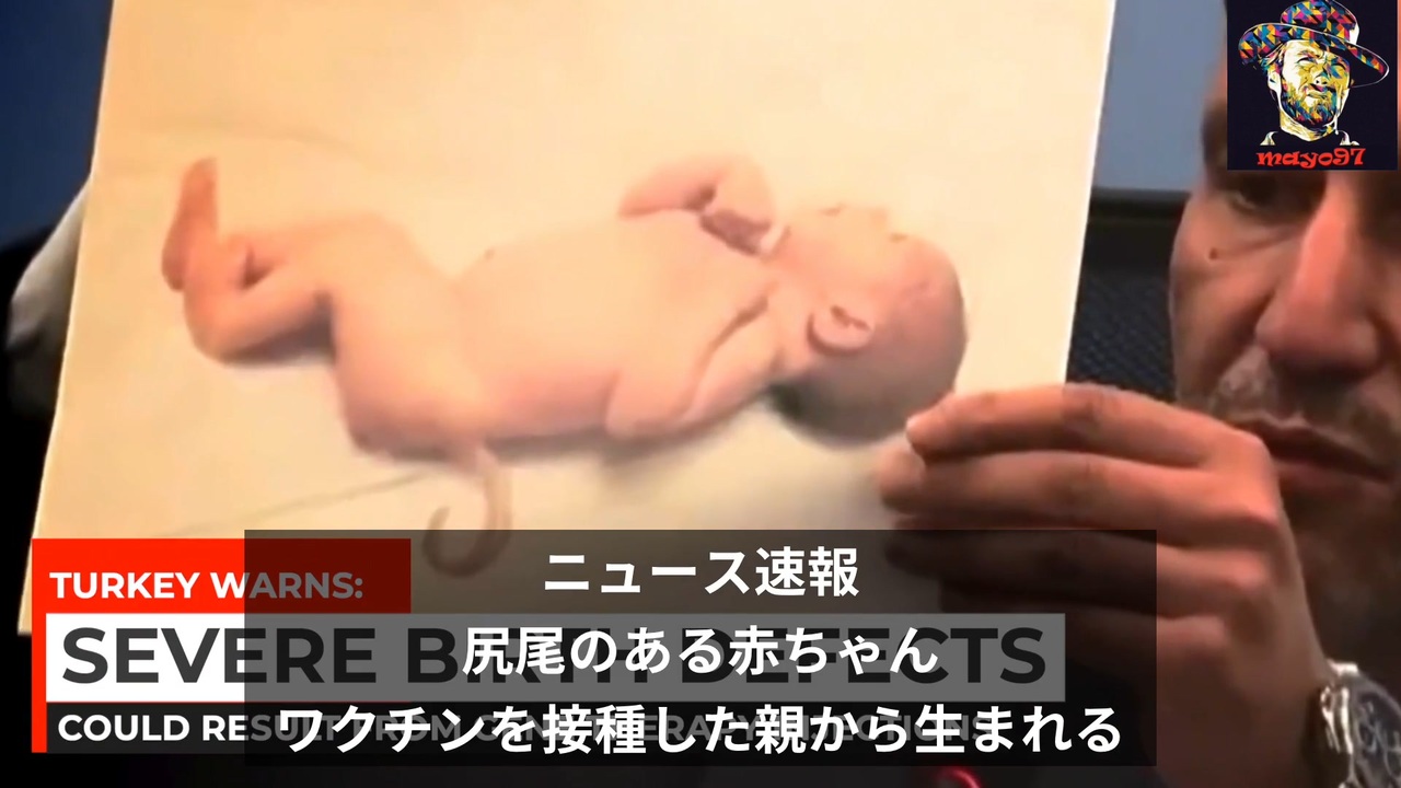 ワクチン接種後の妊婦から生まれた奇形の赤ちゃん ニコニコ動画
