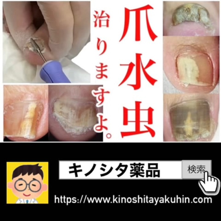 爪水虫 自分で治せますよ ニコニコ動画
