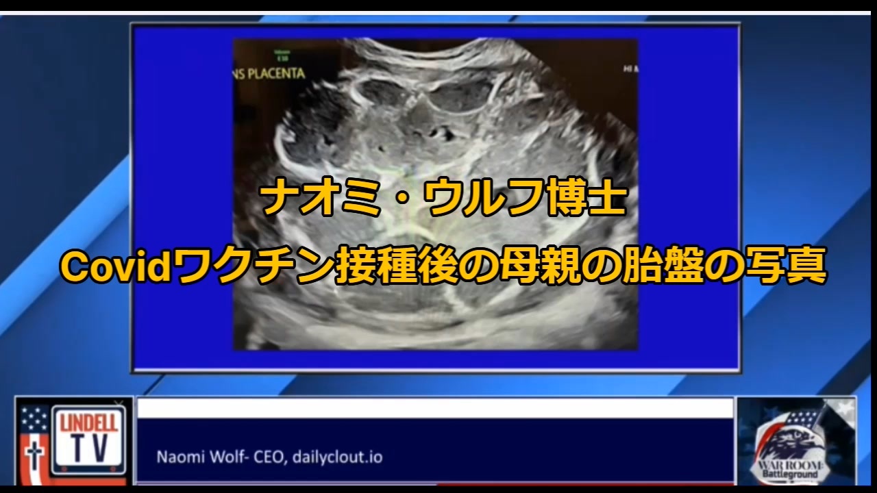 見た事がない胎盤画像 ナオミ ウルフ博士 ニコニコ動画