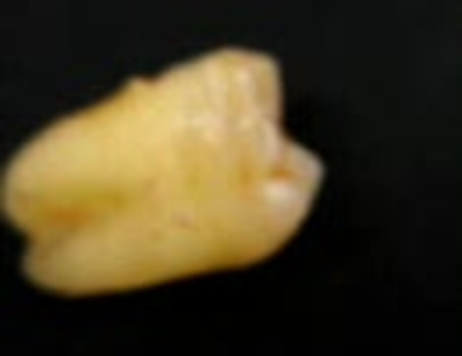 上顎第三大臼歯 ニコニコ動画