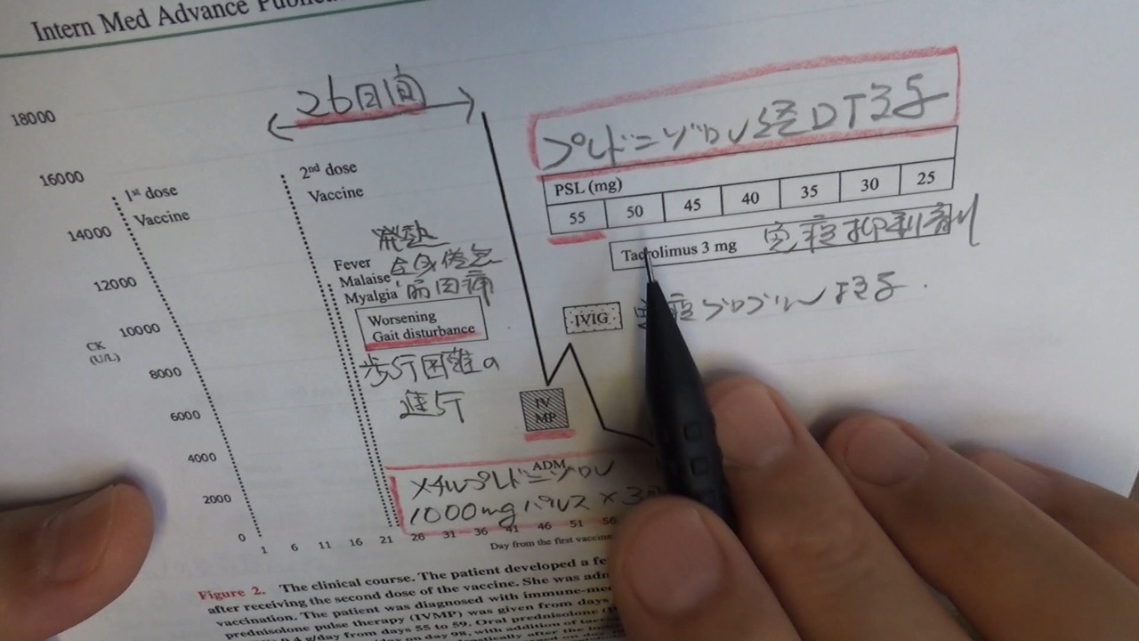 ワクチン後症候群の症例報告論文（札幌医科大学）