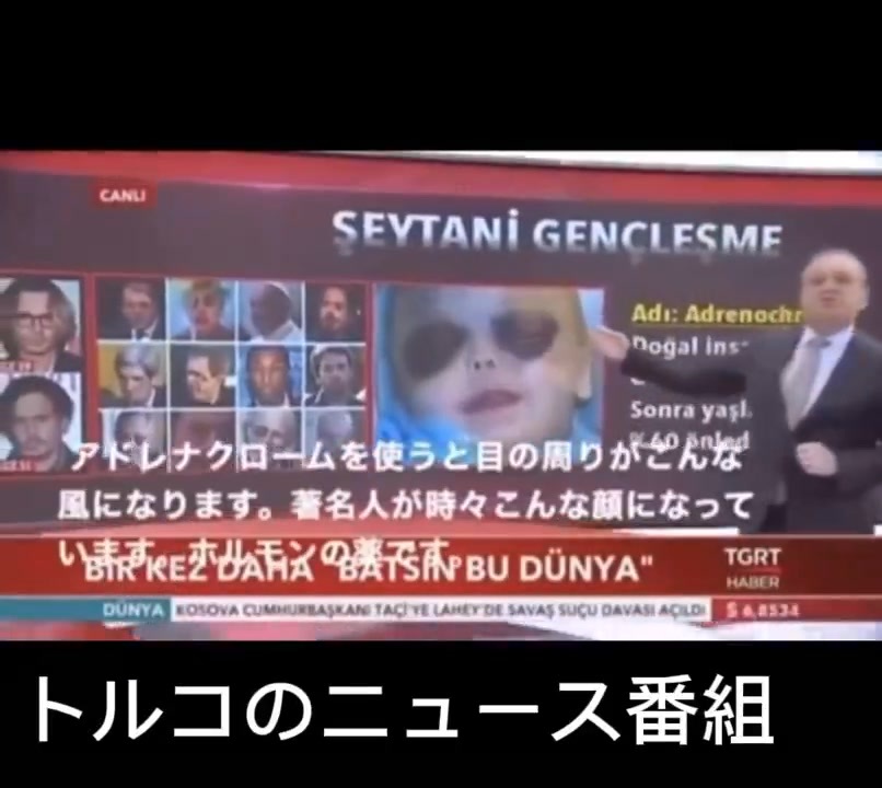 トルコでは完全暴露