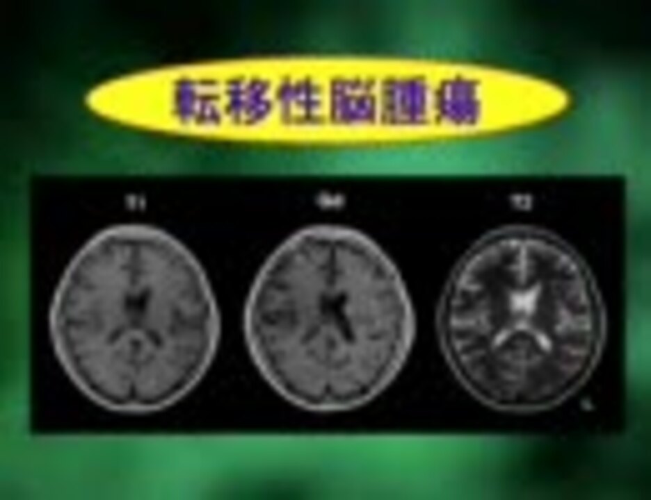 head MRI in Japanese - ニコニコ動画
