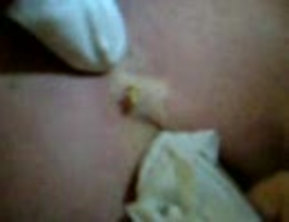 硬め にきびの脂絞り スッキリ ニコニコ動画